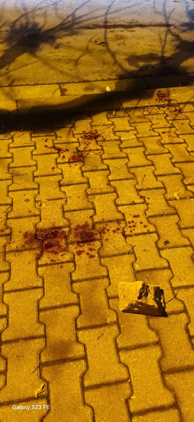 Konya’da kafatası parçalanan çocuk taburcu oldu, saldırgan “baba tahliye” paylaştı 3